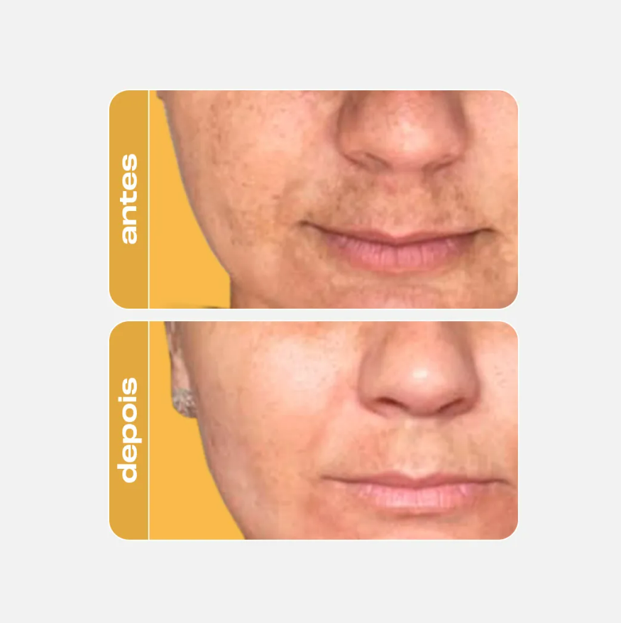 SERUM FACIAL ANTIOXIDANTE CLAREADOR GOLDEN C - CREAMY