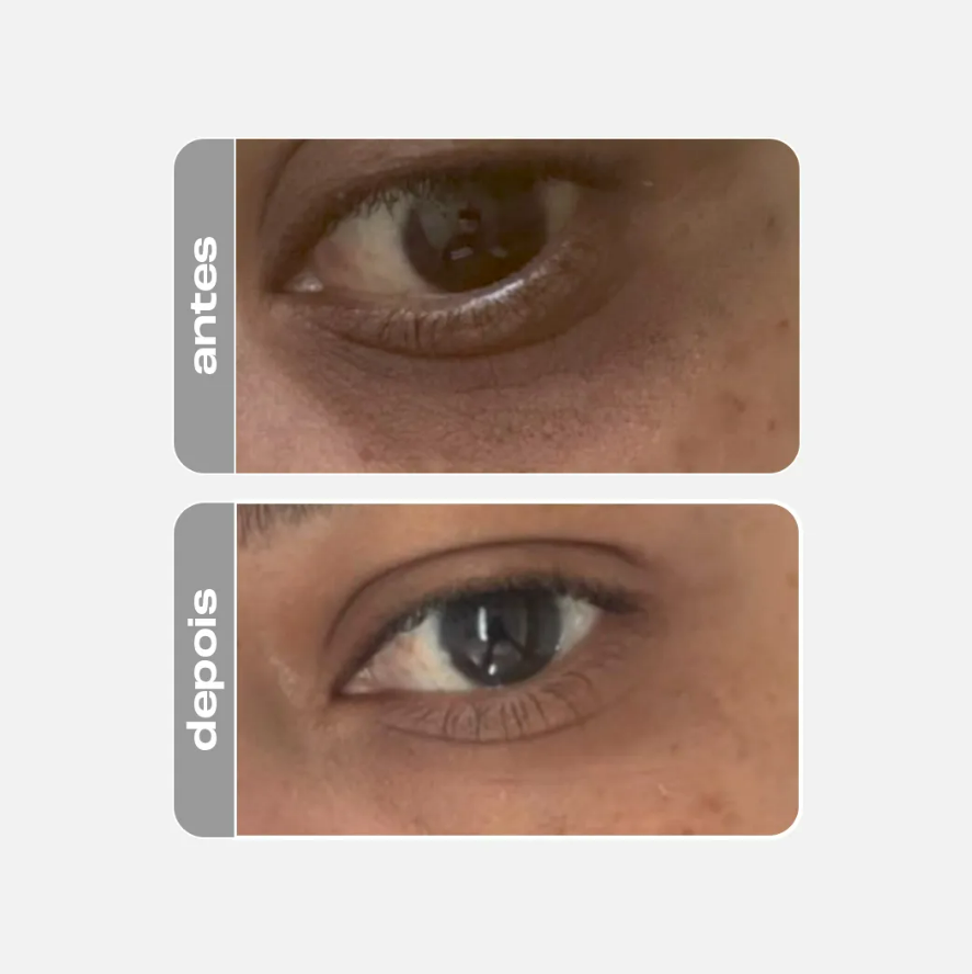 EYE CREAM ATIRRUGAS, CLAREADOR E FIRMADOR - CREAMY