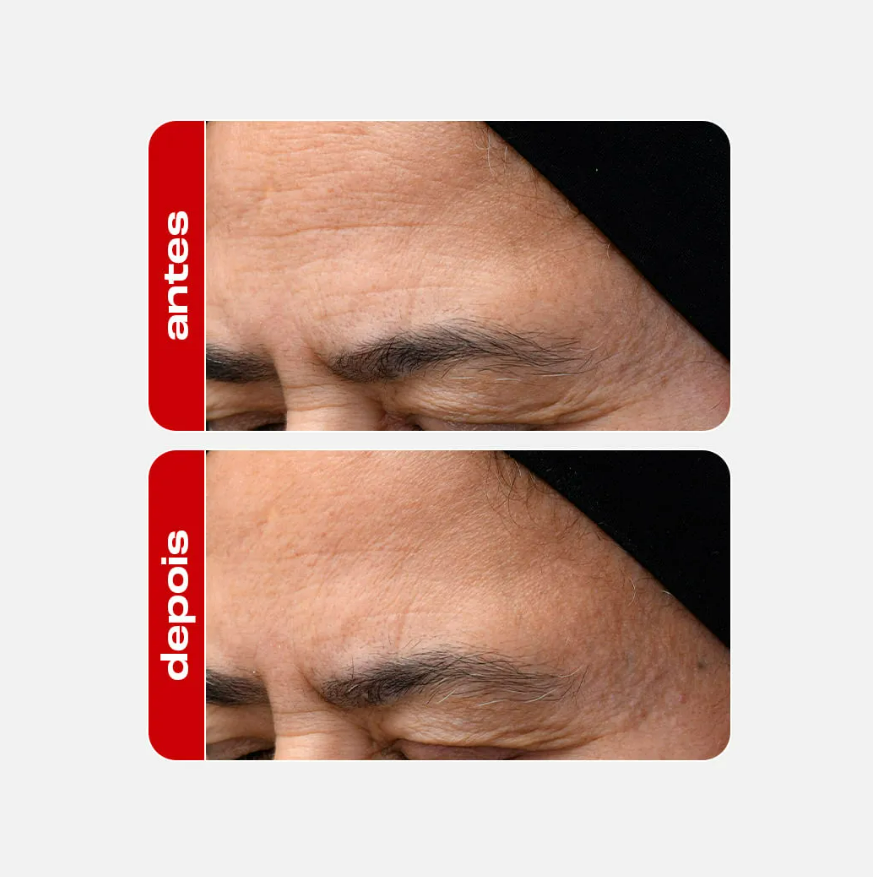 SERUM FACIAL ANTI-IDADE COM RETINAL - CREAMY